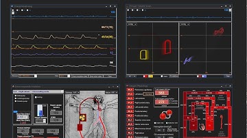 VAECMO started (Donker DW et al)