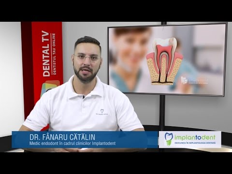 Video: Tratament Dentar Fără Durere - 7 Tratamente Moderne