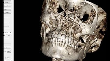 2012 08 21 15 01 InVivo   Volume Rendering Basics