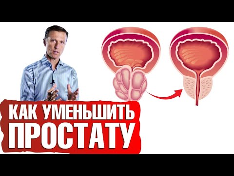 Аденома простаты, увеличение простаты👉причины и решение проблемы