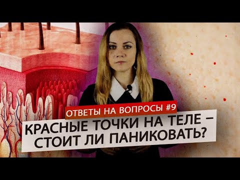 Как лечить красные точки на теле в домашних условиях