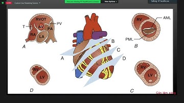 SIÊU ÂM TIẾP CẬN SỐC | ThS. BS. Võ Thị Thúy An