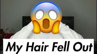 Storytime | My Hair Fell Out!