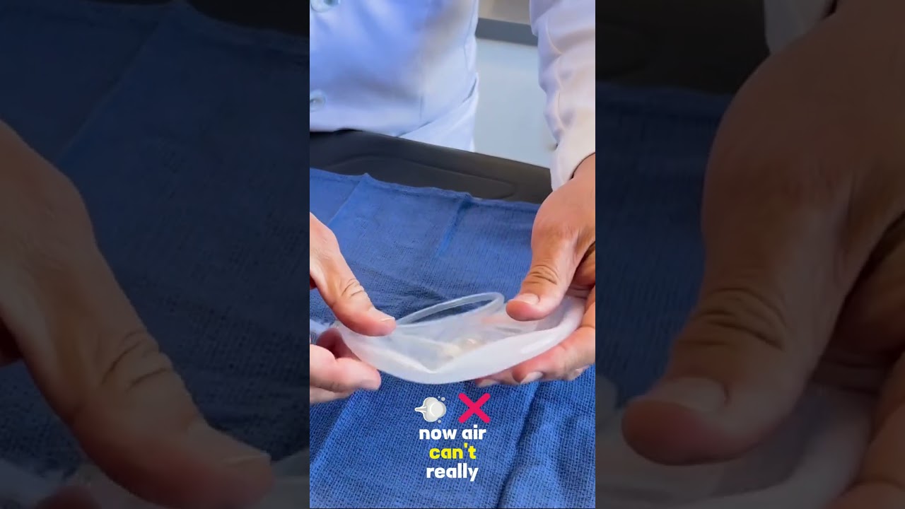 How to use Breast Implant Sizers