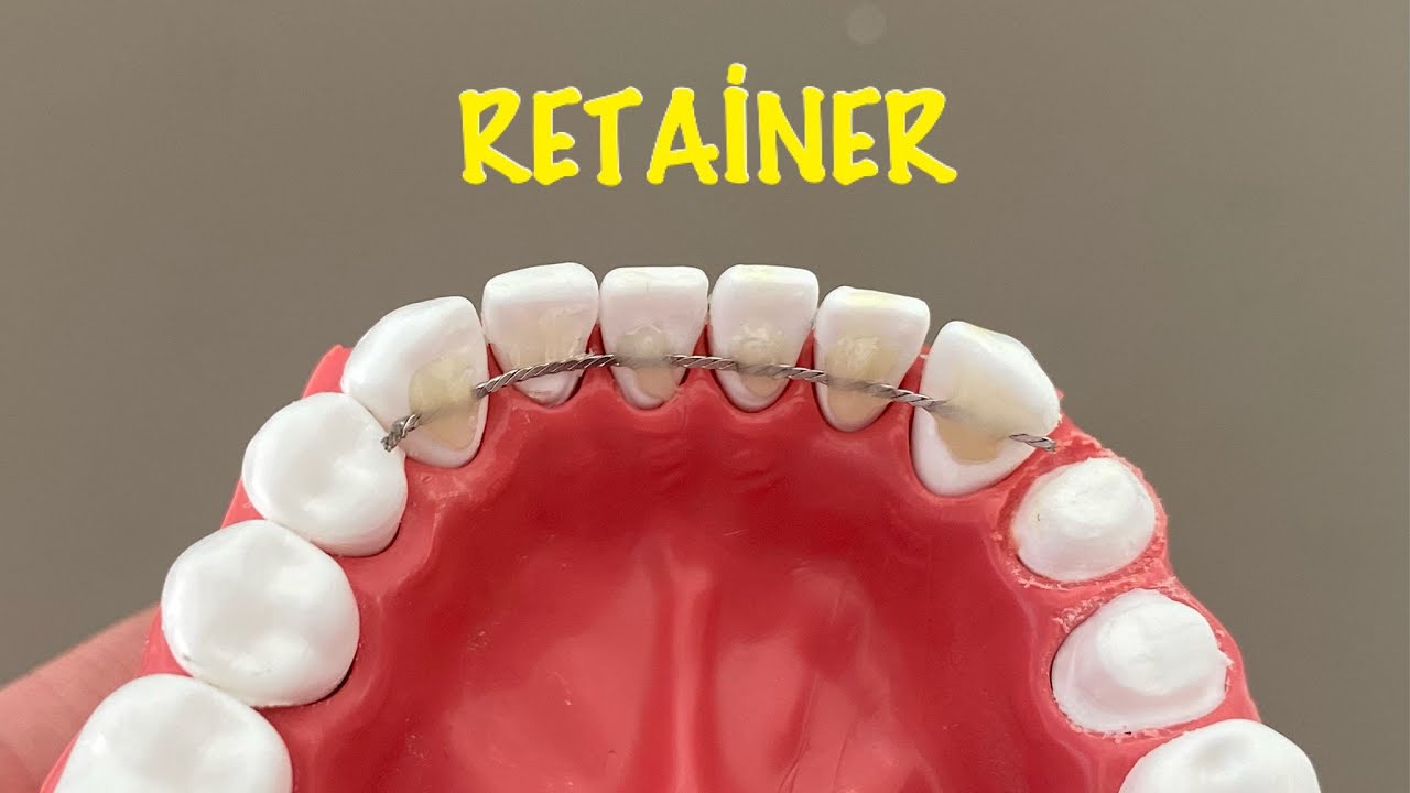 Retainer Teli Nasıl Takılır? | How to replace retainer?