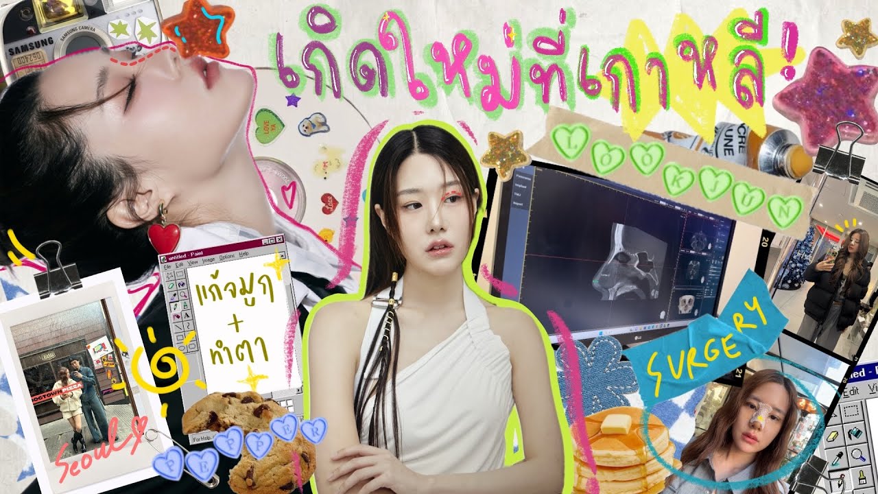 VLOG รีวิวศัลยกรรมแก้จมูก, ทำตา อัพเดตวันต่อวัน! เกิดใหม่ที่เกาหลี🇰🇷✨ | Lookjun&Pepper