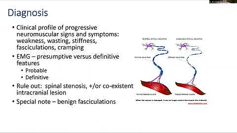 ALS Pathway Presentation with Dr. Jill Calder