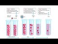 meaning of HIV and the stages of HIV