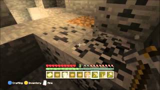 Exile Vs. Episode: 2 Setting Up