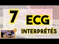 7 ecg interprts en live  rediffusion