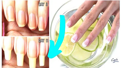 ¿Cómo hacer crecer las uñas en 3 días con limón?