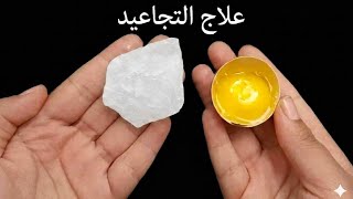 ضع الشبة على بيضة،، لن تصدق النتائج!! لا تخطر على بال العفريت مدهشة""!؟
