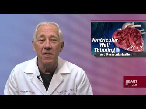 Heart Minute | Ventricular Wall Thinning, Scar, and Revasc. Benefit