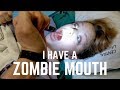 High on Anesthesia After Tonsillectomy || FUNNY with subtitles