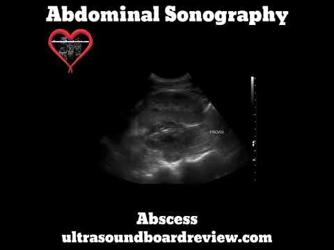 Abscess