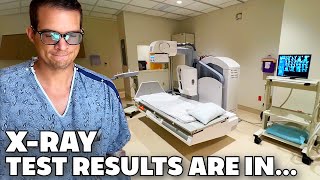 GOING TO THE HOSPITAL FOR A BARIUM SWALLOW TEST  RECEIVING XRAY RESULTS ESOPHAGUS TEAR LEAKING?