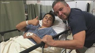 Growing Up San Diego: Laser surgery helps children with burn injuries