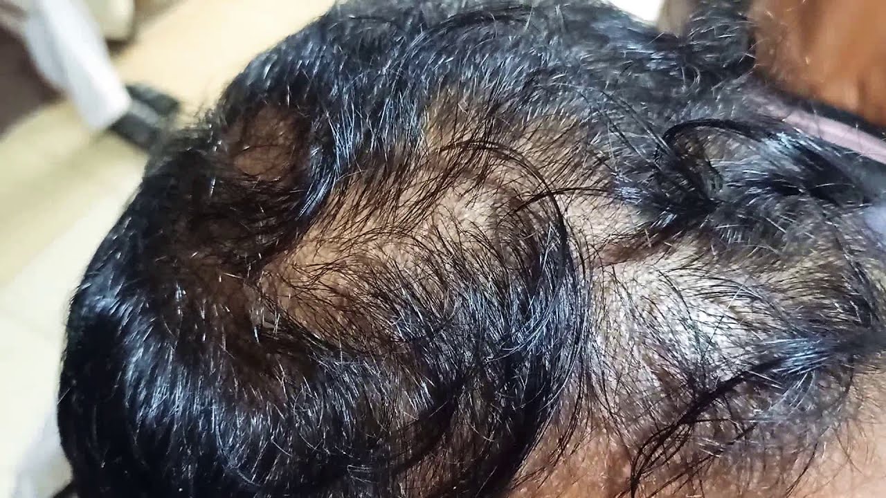 headshave Head massage head shave men's Head shave hair regrowth