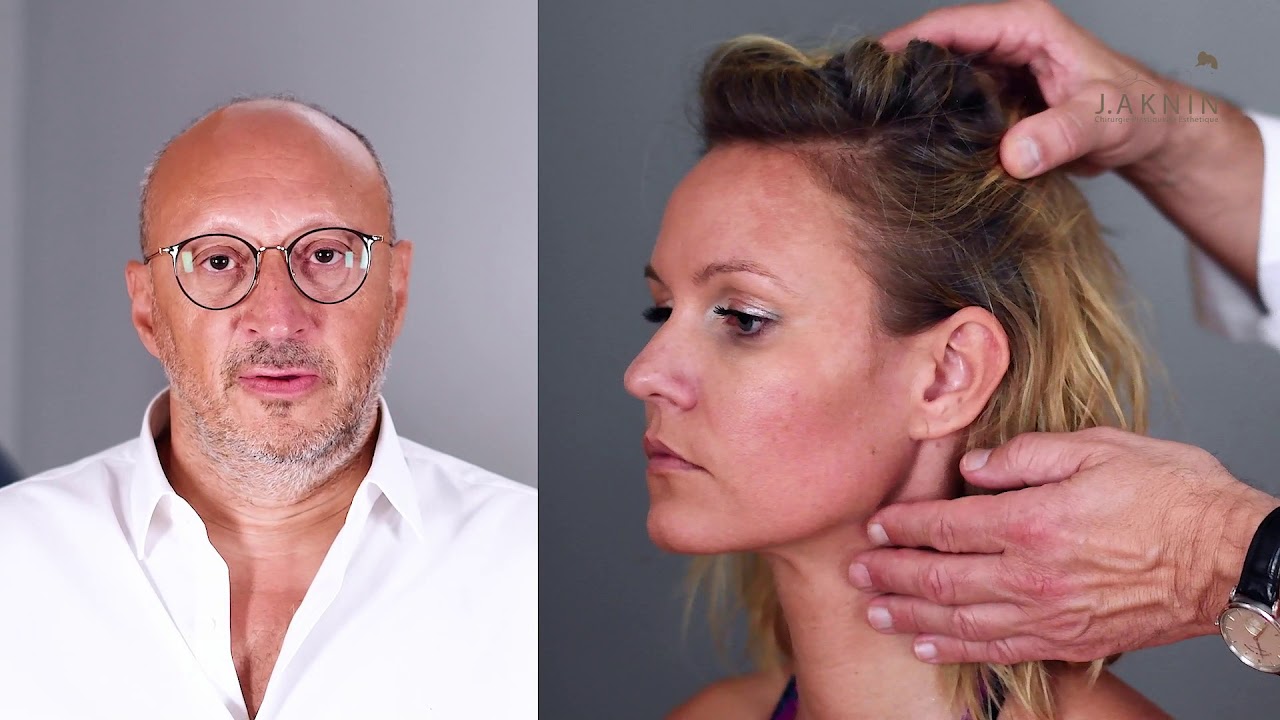 Le lifting facial sous anesthésie locale - Dr Aknin