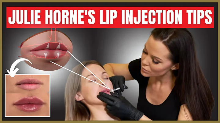 Julie Horne's Lip Injection Tips | Treating M Shap...