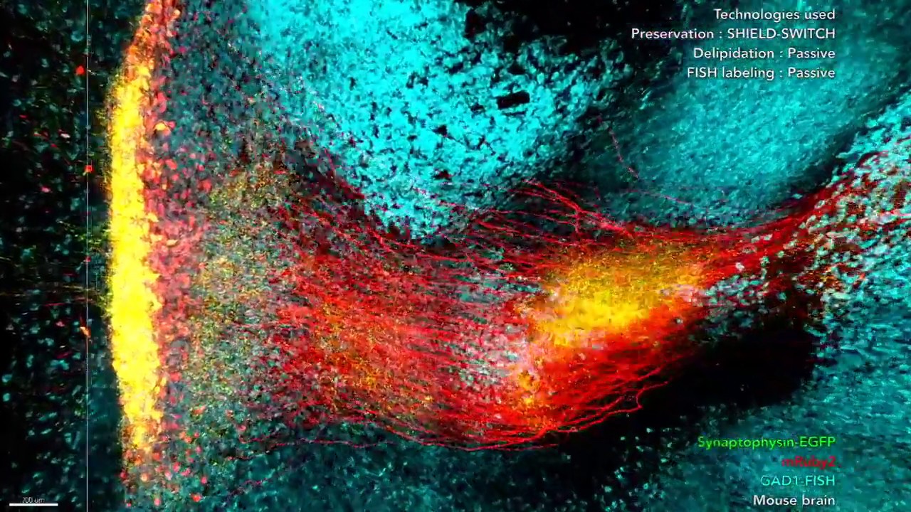 Визуализация структуры мозга External globus pallidus