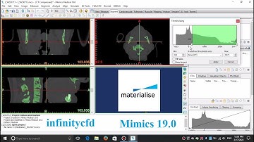 Setting threshold range in Mimics for mask creation and extracting geometry from CT-Scan images.