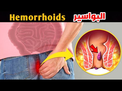 ازاي تعرف ان عندك بواسير       