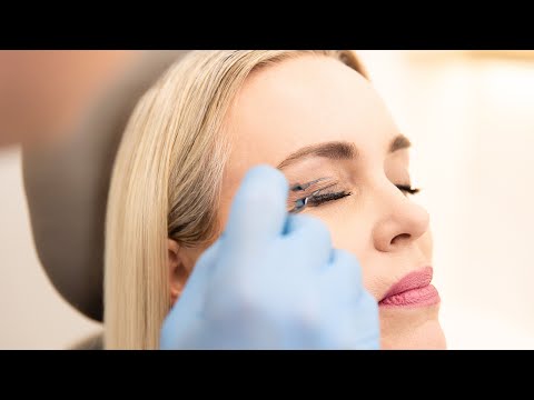 Dr. Brace talks Cosmetic Eyelid Concerns