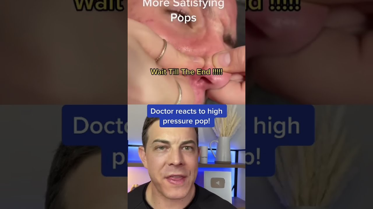 CRAZY Painful Pimple Pop 208SkinDoc
