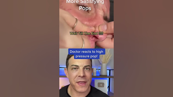 CRAZY Painful Pimple Pop! | 208SkinDoc