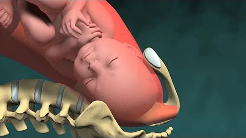 医学动画：婴儿出生（阴道生产） - 天天要闻