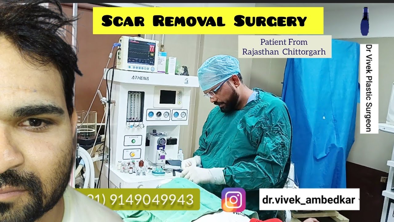 Scar Revision Scar Removal Surgery Face Scar Best Scar Surgeon