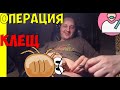 Как вытащить клеща в домашних условиях! Операция &quot;КЛЕЩ&quot;! [Zona комфорта]