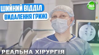 Видалення Грижі у Шийному Відділі Хребта. Реальна Хірургія.