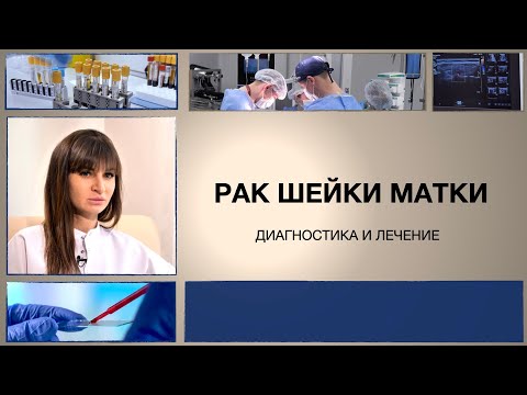 Рак шейки матки: диагностика и лечение.