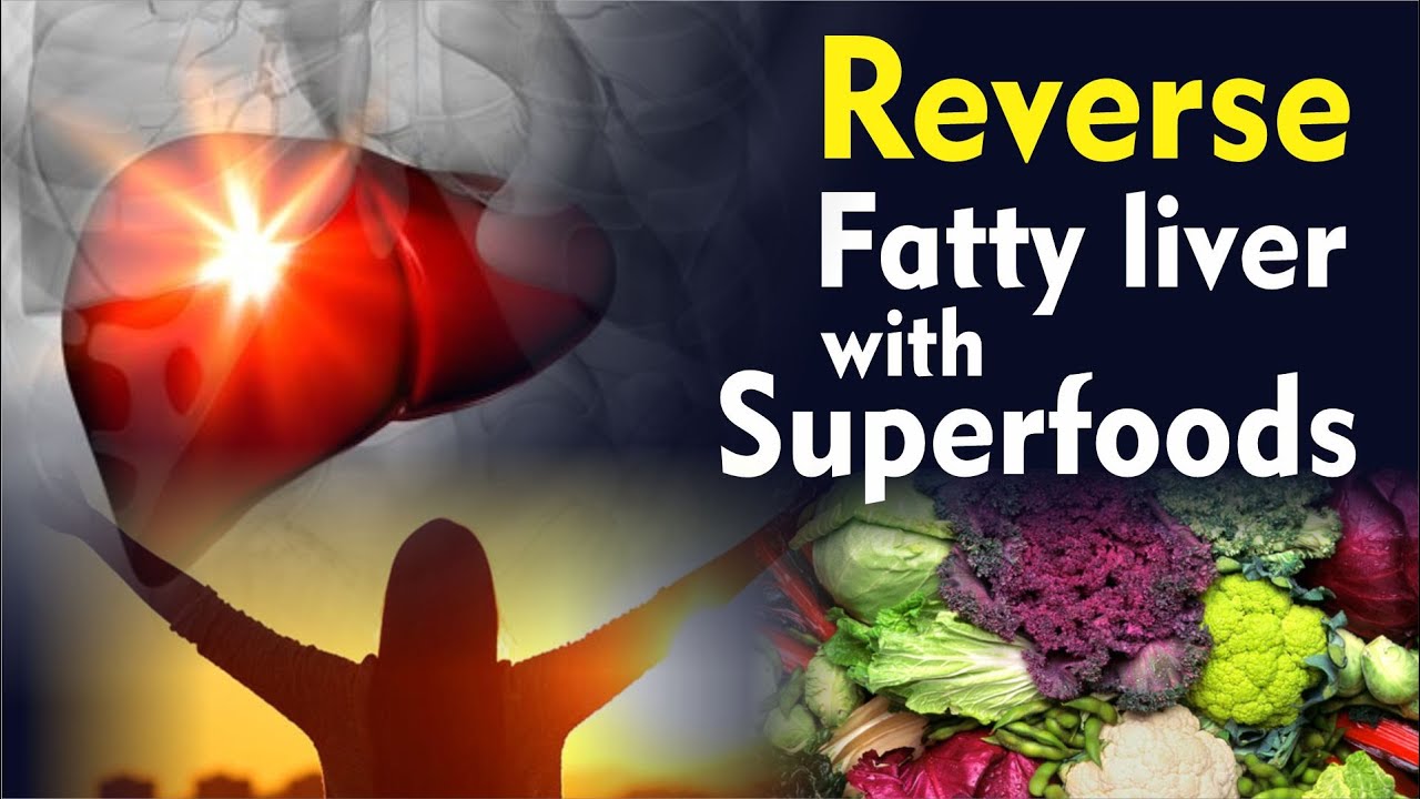Reverse your Fatty Liver with Superfoods | Dr. Jawwad Afzal Kayani