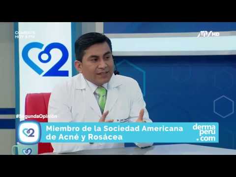 botox meaning Cicatrices de Acne. Tipos. Como evaluar mejor.Microfotografia digital 3D Lima Peru Dr Aparcana