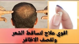 اقوي علاج لتساقط الشعر بانواعة وكمان بيساعد علي انبات الشعر وبيعالج تقصف الشعر/#pantogar-capsol#