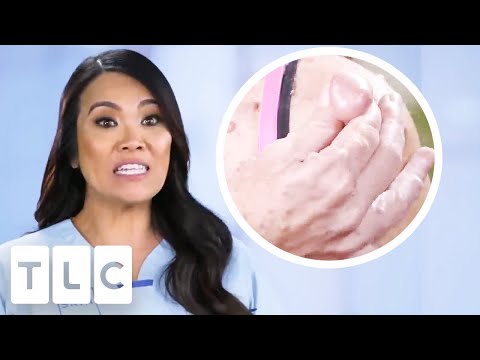 Dr. Lee's MOST Interesting Cases: Mysterious Rashes, Cysts & More! | Dr Pimple Popper