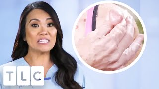 Dr. Lee's MOST Interesting Cases: Mysterious Rashes, Cysts \& More! | Dr Pimple Popper