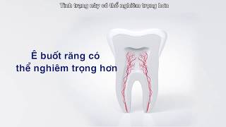 Sensodyne | Ê Buốt Răng Có Thể Nghiêm Trọng Hơn Bạn Nghĩ