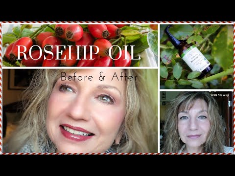 Video: Rosehip Wrinkled