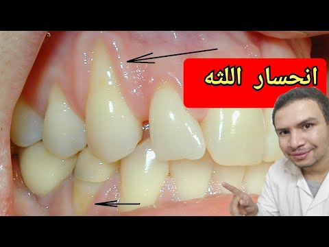 فيديو: هل يمكن أن تنمو أمبوليا؟