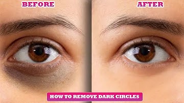Photoshop Tutorial: Remove Dark Circles Instantly! | Easy Step-by-Step Guide
