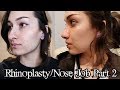 I GOT A NOSE JOB! RECOVERY + BEFORE AND AFTERS! | Scream Kiwi