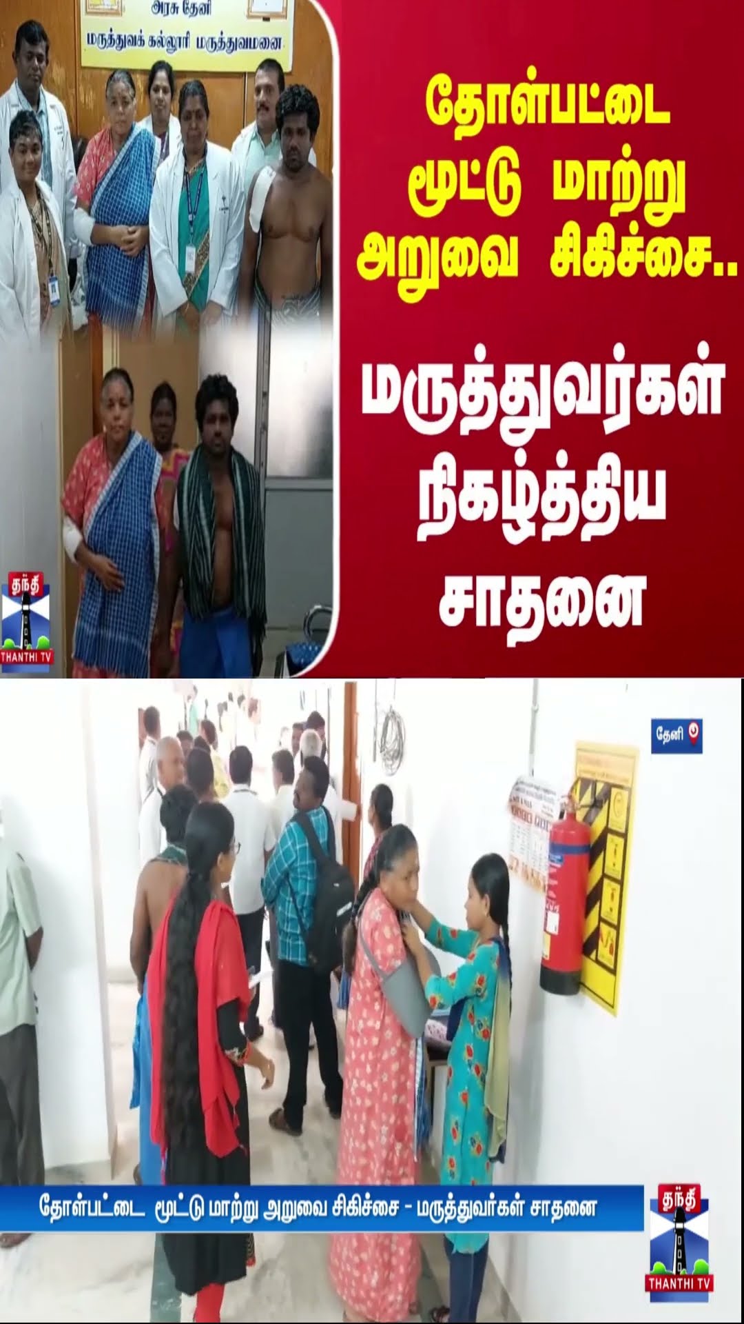 தோள்பட்டைமூட்டு மாற்று அறுவை சிகிச்சை.. அரசு மருத்துவர்கள் நிகழ்த்திய சாதனை