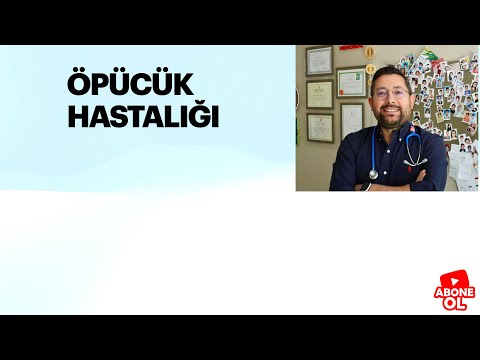 Öpücük Hastalığı, Enfeksiyöz Mononükleoz, Mono Hastalığı, Prof Dr Ahmet Demir