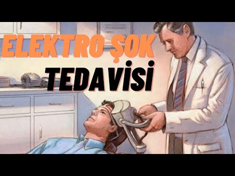 Elektroşok terapiyası - EKT nədir?