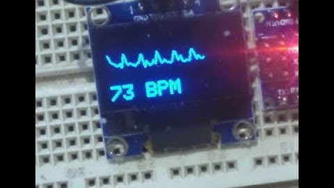 Heart/pulse sensor with Arduino