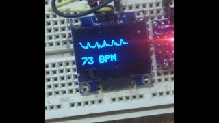 Heart/pulse sensor with Arduino